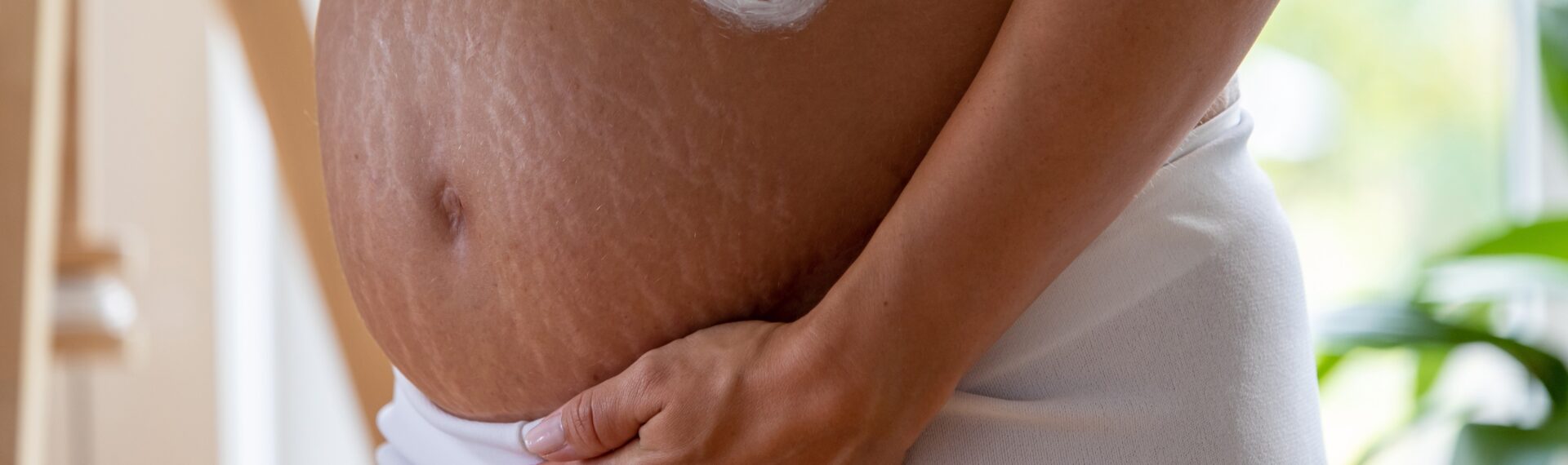 Eine Frau hält eine Creme gegen Dehnungsstreifen in der Hand. Dieses Bild veranschaulicht die Anwendung von Pflegeprodukten, die speziell für Schwangerschaftsstreifen entwickelt wurden, um die Haut elastisch und geschmeidig zu halten. • Dehnungsstreifen Schwangerschaft vermeiden • Schwangerschaftsstreifen Vorbeugung • Cremes gegen Schwangerschaftsstreifen • Öle gegen Dehnungsstreifen Schwangerschaft • Hautpflege Schwangerschaft • Schwangerschaftsstreifen verhindern • Tipps gegen Schwangerschaftsstreifen • Vorbeugung Dehnungsstreifen Schwangerschaft • Mittel gegen Schwangerschaftsstreifen • Wie Dehnungsstreifen vermeiden