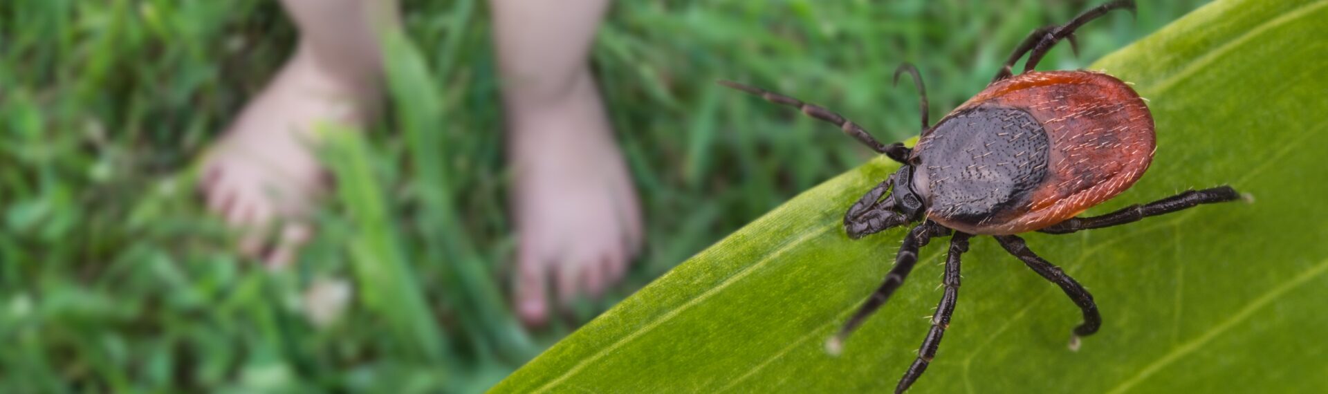 Zeckenbiss was tun; Zeckenimpfung; Zecken entfernen; Haushaltsmittel bei Zecken, Symptome nach Zeckenbiss Kinder; Zeckenbiss Kinder wann zum Arzt, Wie sieht ein Zeckenbiss aus, Zeckenbiss Ausschlag, Zeckenbiss Antibiotika, Zeckenbiss Anzeichen, Zeckenbiss ätherische Öle, Zeckenbiss desinfizieren Hausmittel, Kinder nach Zecken untersuchen, Kleinkinder und Zecken, FSME-Impfung, Kinder Zecken Impfung, Zeckenbiss und jetzt, Nebenwirkung Zeckenbiss Kind